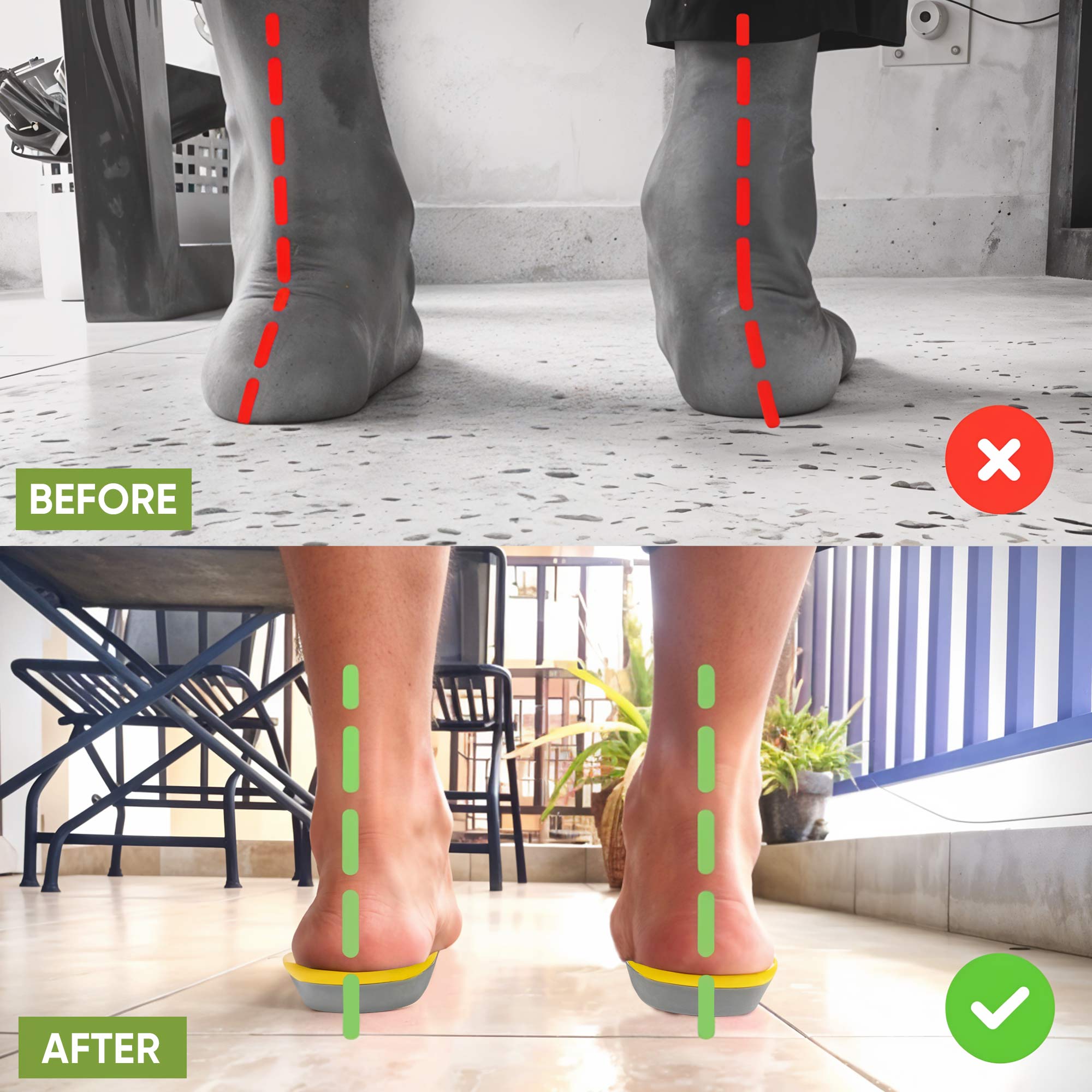 Gel Insoles for Shoes -  All Day Comfort for Arch Support & Trim Inserts to Fit Shoes