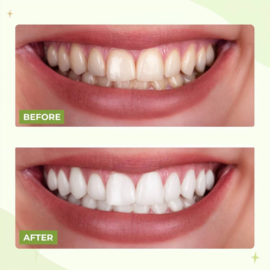 Electric Teeth Flosser - Water Dental Flosser Teeth Pick